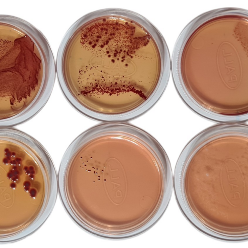 CROMOKIT CUP-12 AGAR El medio que le ahorra retiradas de mercado de cosméticos por contener “patógenos no especificados”