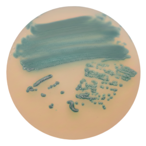 BAIRD PARKER BPX19Y CROMOGENIC AGAR (S. aureus)