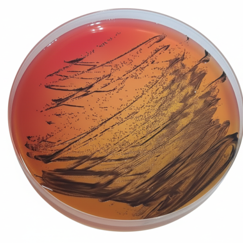 BAIRD PARKER MANNITOL (BPM) AGAR (aislamiento rápido y selectivo de Staphylococcus aureus)