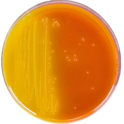 LENA Medio agarizado para detección de Clostridium perfringens en alimentos según ISO15213 de 2024