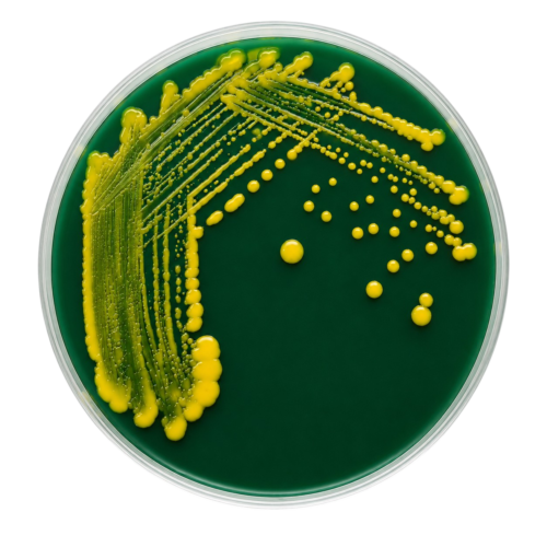 VIBRIO VULNIFICUS CPC AGAR CELOBIOSA-POLIMIXINA-COLISTINA Aislamiento selectivo de Vibrio vulnificus (BAM, FDA)